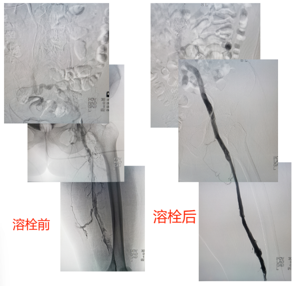 1291c17d63dc4be5ab2e4caa4c408151.png